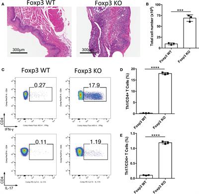 Regulatory T cell therapy suppresses inflammation of oral mucosa